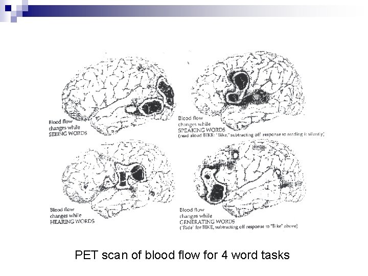 PET scan of blood flow for 4 word tasks 