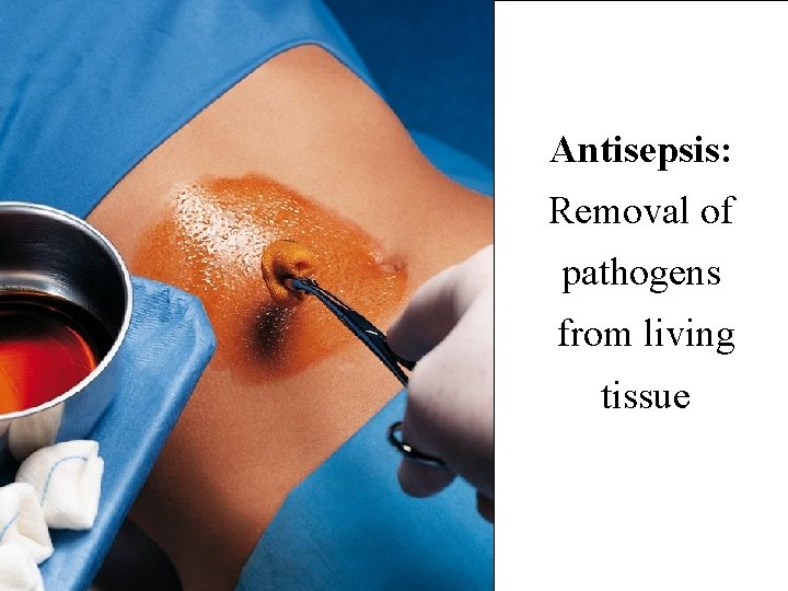 Antisepsis: Removal of pathogens from living tissue Copyright © 2004 Pearson Education, Inc. ,