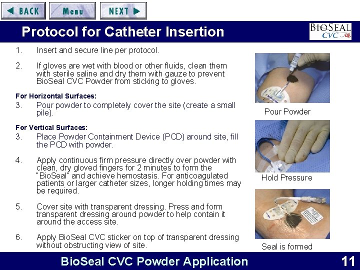 Protocol for Catheter Insertion 1. Insert and secure line per protocol. 2. If gloves