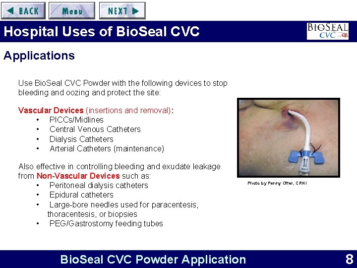 Hospital Uses of Bio. Seal CVC Applications Use Bio. Seal CVC Powder with the