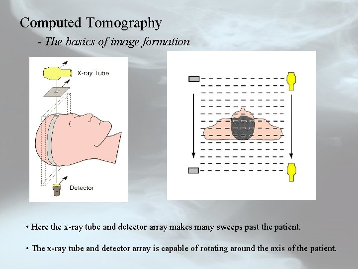 Computed Tomography - The basics of image formation • Here the x-ray tube and