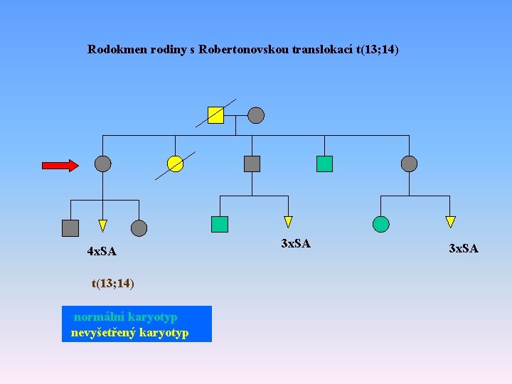 Rodokmen rodiny s Robertonovskou translokací t(13; 14) 4 x. SA t(13; 14) normální karyotyp