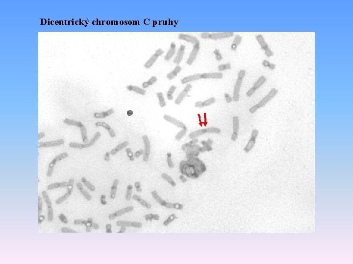 Dicentrický chromosom C pruhy 