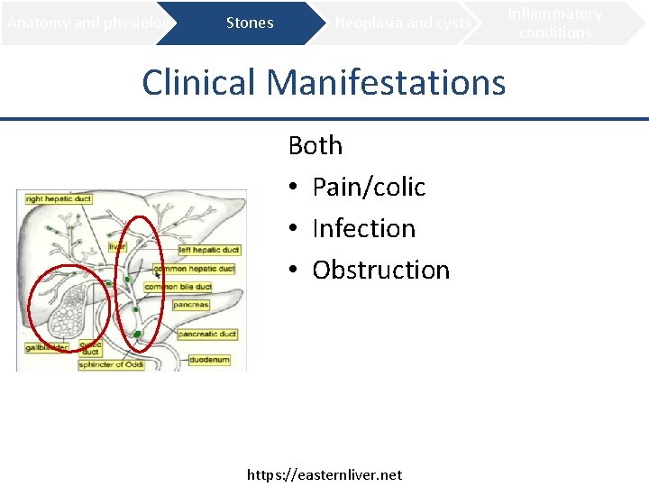 Anatomy and physiology Stones Neoplasia and cysts Clinical Manifestations Both • Pain/colic • Infection