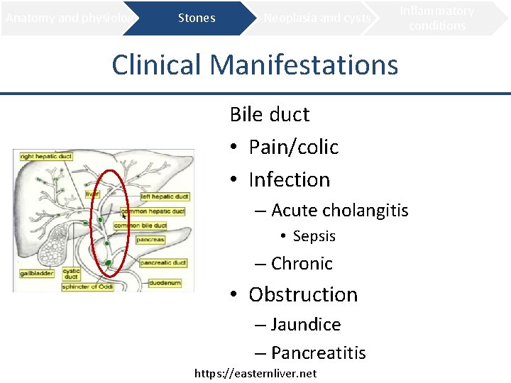 Anatomy and physiology Stones Neoplasia and cysts Inflammatory conditions Clinical Manifestations Bile duct •