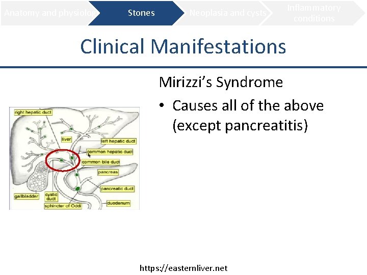 Anatomy and physiology Stones Neoplasia and cysts Inflammatory conditions Clinical Manifestations Mirizzi’s Syndrome •