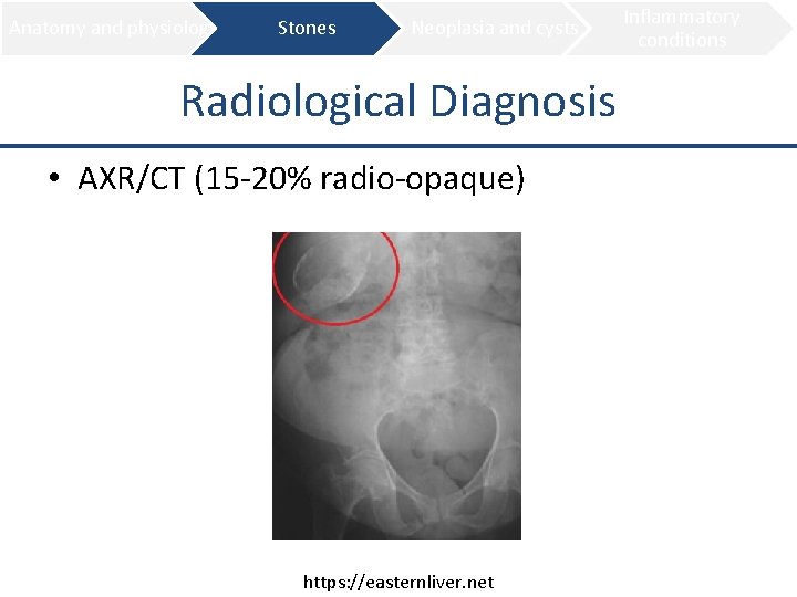 Anatomy and physiology Stones Neoplasia and cysts Radiological Diagnosis • AXR/CT (15 -20% radio-opaque)