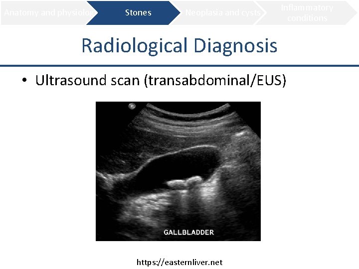 Anatomy and physiology Stones Neoplasia and cysts Inflammatory conditions Radiological Diagnosis • Ultrasound scan