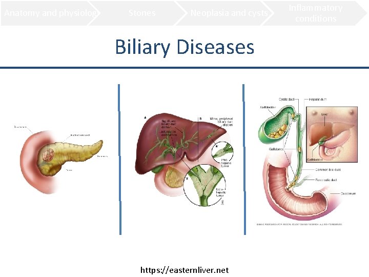 Anatomy and physiology Stones Neoplasia and cysts Biliary Diseases https: //easternliver. net Inflammatory conditions