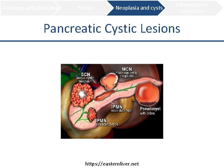 Anatomy and physiology Stones Neoplasia and cysts Inflammatory conditions Pancreatic Cystic Lesions https: //easternliver.