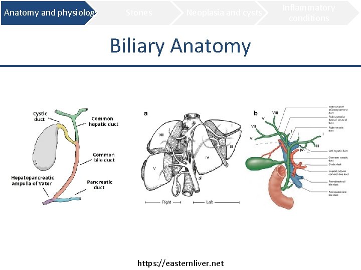 Anatomy and physiology Stones Neoplasia and cysts Biliary Anatomy https: //easternliver. net Inflammatory conditions