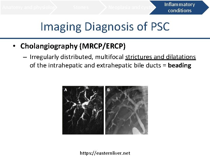 Anatomy and physiology Stones Neoplasia and cysts Inflammatory conditions Imaging Diagnosis of PSC •