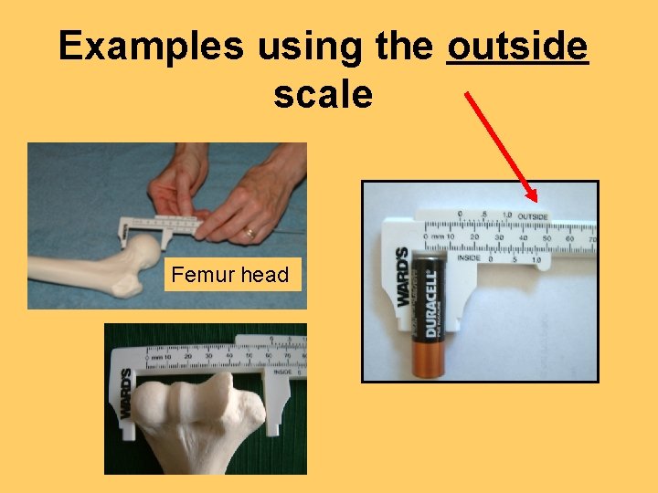 Examples using the outside scale Femur head 