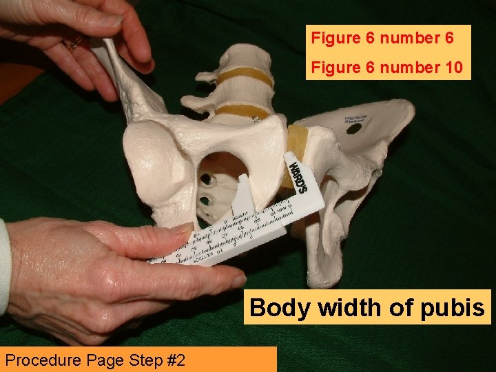 Figure 6 number 6 Figure 6 number 10 Body width of pubis Procedure Page