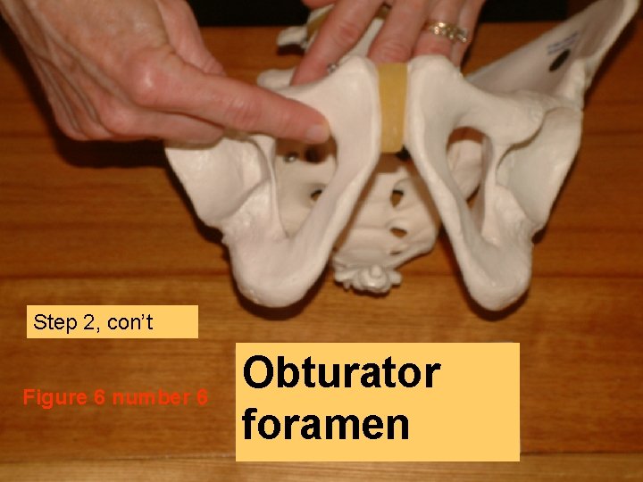 Step 2, con’t Figure 6 number 6 Obturator foramen 