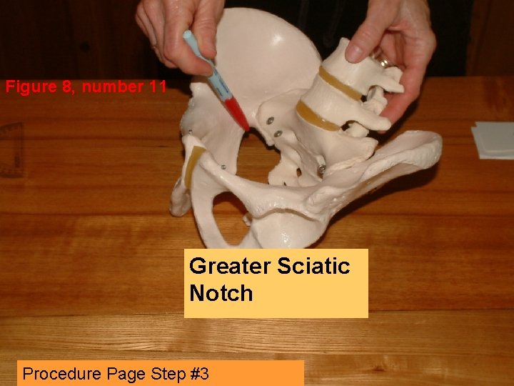 Figure 8, number 11 Greater Sciatic Notch Procedure Page Step #3 