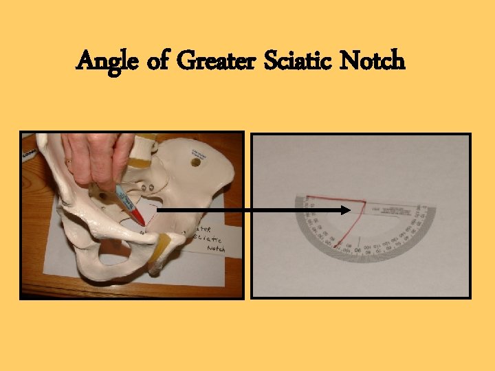 Angle of Greater Sciatic Notch 