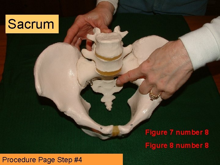 Sacrum Figure 7 number 8 Figure 8 number 8 Procedure Page Step #4 