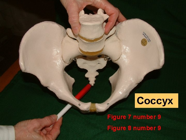 Coccyx Figure 7 number 9 Figure 8 number 9 