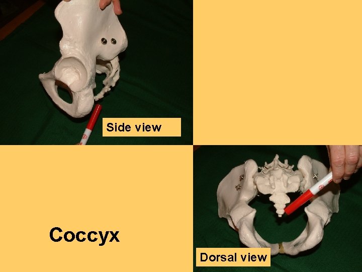 Side view Coccyx Dorsal view 
