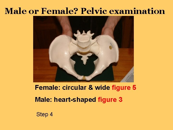Male or Female? Pelvic examination Female: circular & wide figure 5 Male: heart-shaped figure