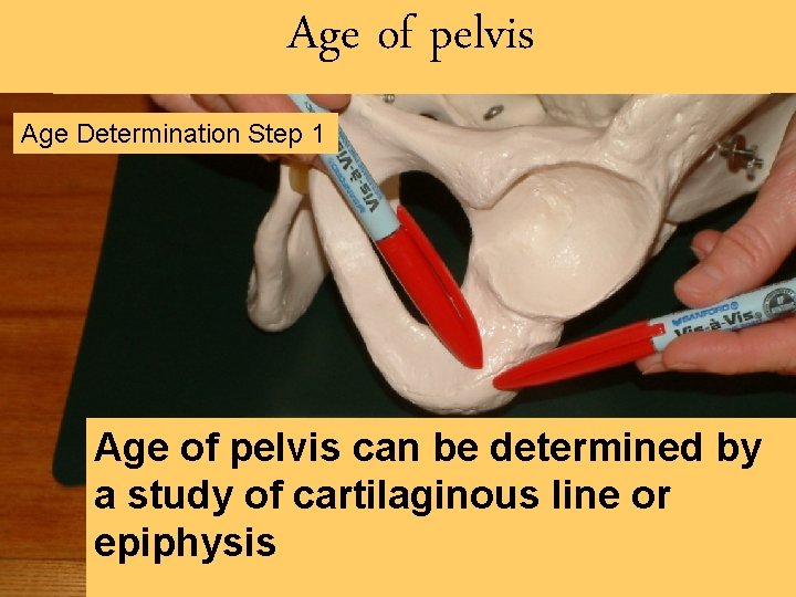 Age of pelvis Age Determination Step 1 Age of pelvis can be determined by