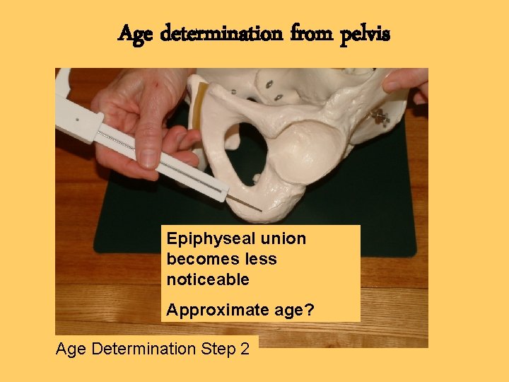 Age determination from pelvis Epiphyseal union becomes less noticeable Approximate age? Age Determination Step