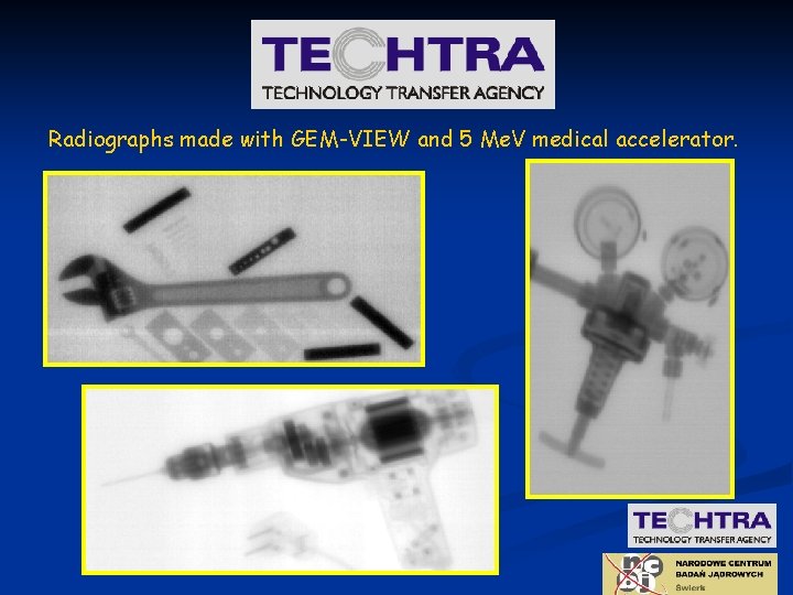 Radiographs made with GEM-VIEW and 5 Me. V medical accelerator. 
