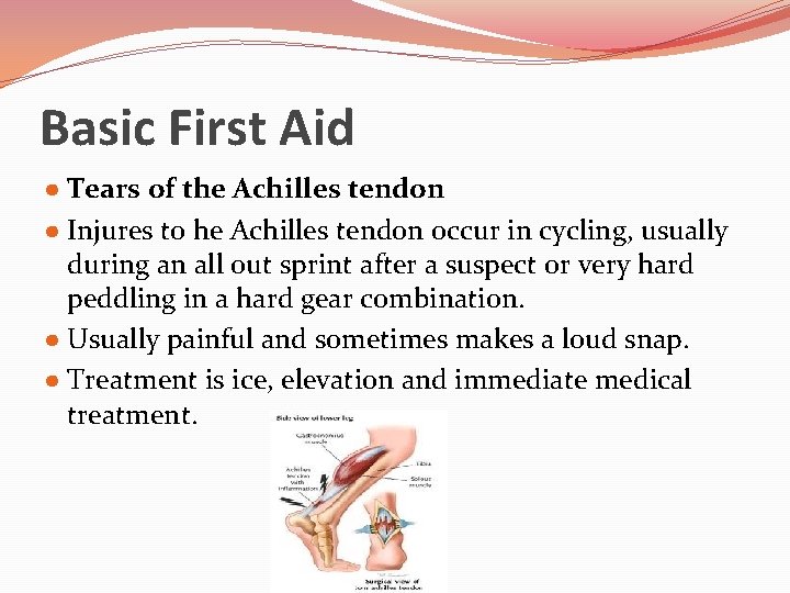 Basic First Aid ● Tears of the Achilles tendon ● Injures to he Achilles