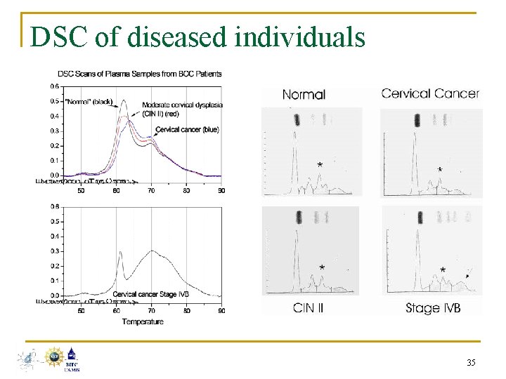 DSC of diseased individuals 35 