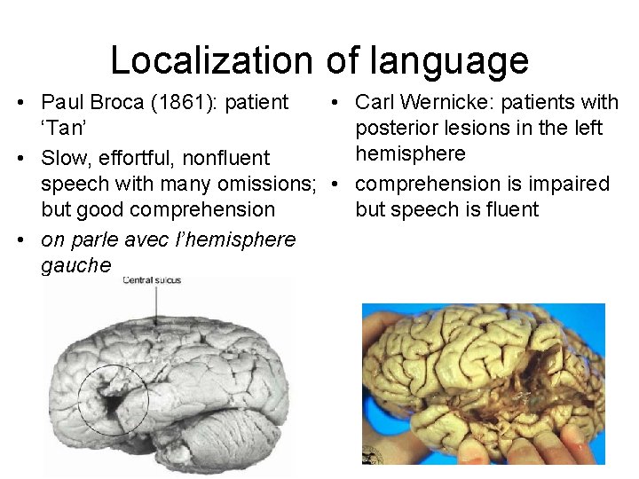 Localization of language • Paul Broca (1861): patient • Carl Wernicke: patients with ‘Tan’