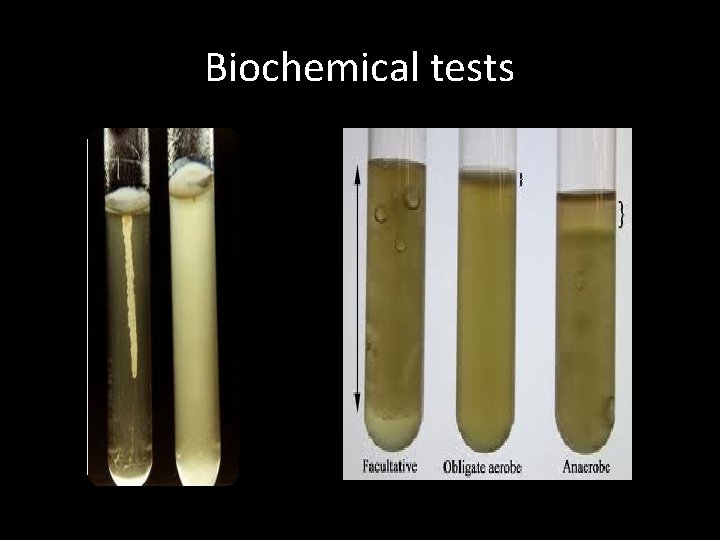 Biochemical tests 