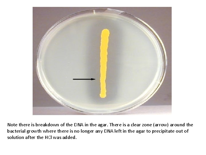 Note there is breakdown of the DNA in the agar. There is a clear