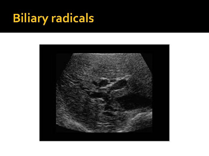 Biliary radicals 