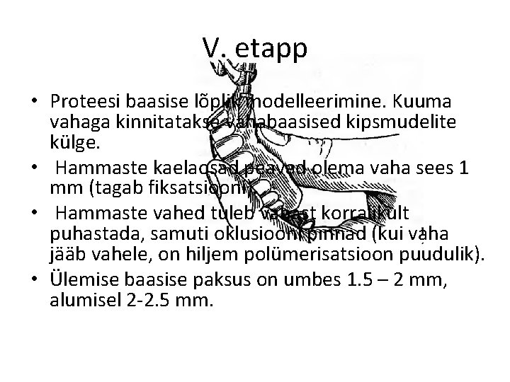 V. etapp • Proteesi baasise lõplik modelleerimine. Kuuma vahaga kinnitatakse vahabaasised kipsmudelite külge. •