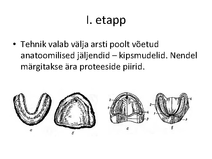 I. etapp • Tehnik valab välja arsti poolt võetud anatoomilised jäljendid – kipsmudelid. Nendel