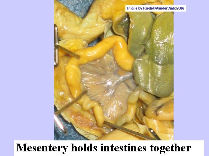 Image by Riedell/Vander. Wal© 2006 Mesentery holds intestines together 