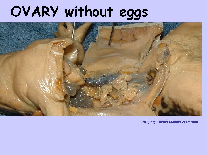 OVARY without eggs Image by Riedell/Vander. Wal© 2006 