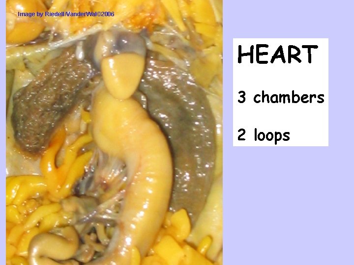 Image by Riedell/Vander. Wal© 2006 HEART 3 chambers 2 loops 