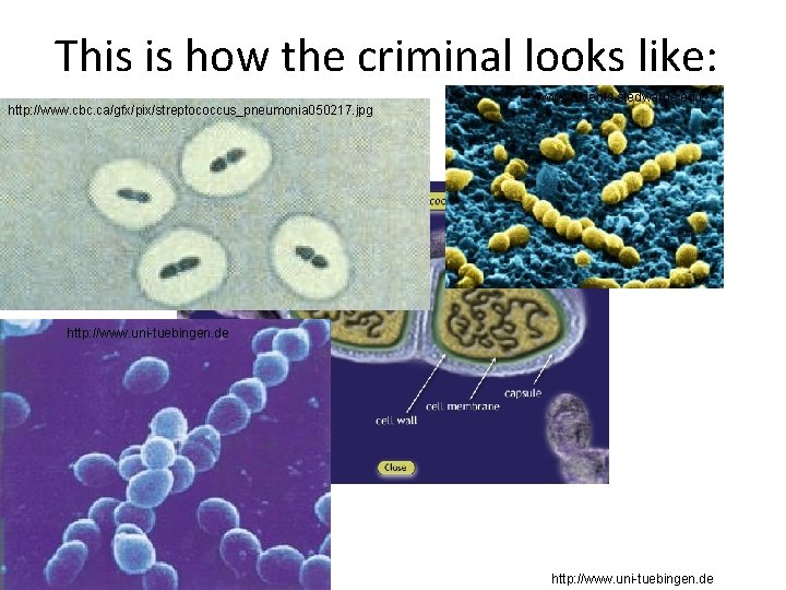 This is how the criminal looks like: http: //www. cbc. ca/gfx/pix/streptococcus_pneumonia 050217. jpg www.