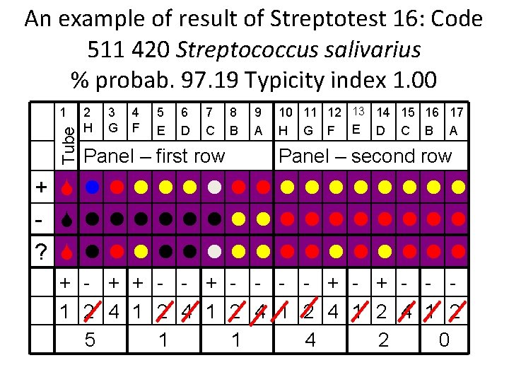 An example of result of Streptotest 16: Code 511 420 Streptococcus salivarius % probab.