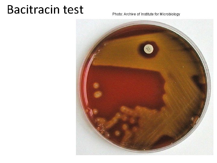 Bacitracin test Photo: Archive of Institute for Microbiology 