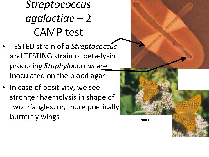 Streptococcus agalactiae – 2 CAMP test • TESTED strain of a Streptococcus and TESTING