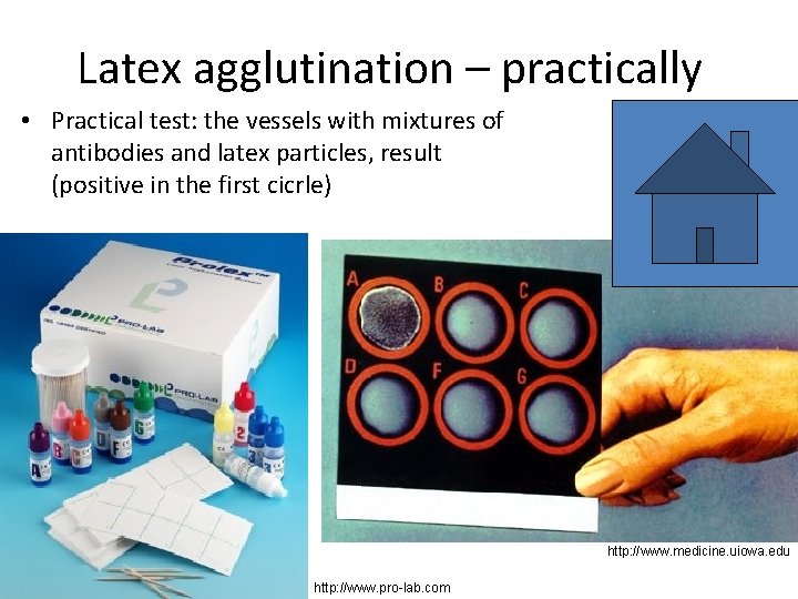 Latex agglutination – practically • Practical test: the vessels with mixtures of antibodies and