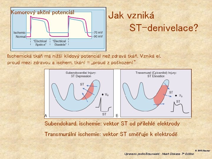 Komorový akční potenciál Jak vzniká ST-denivelace? Ischemická tkáň má nižší klidový potenciál než zdravá