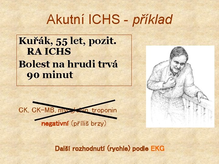 Akutní ICHS - příklad Kuřák, 55 let, pozit. RA ICHS Bolest na hrudi trvá