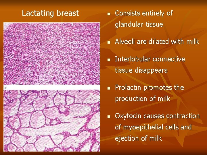 Lactating breast n Consists entirely of glandular tissue n Alveoli are dilated with milk