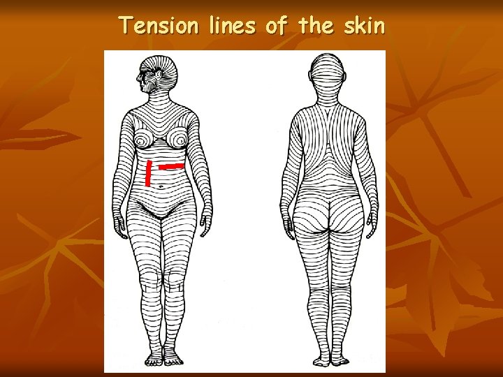 Tension lines of the skin 