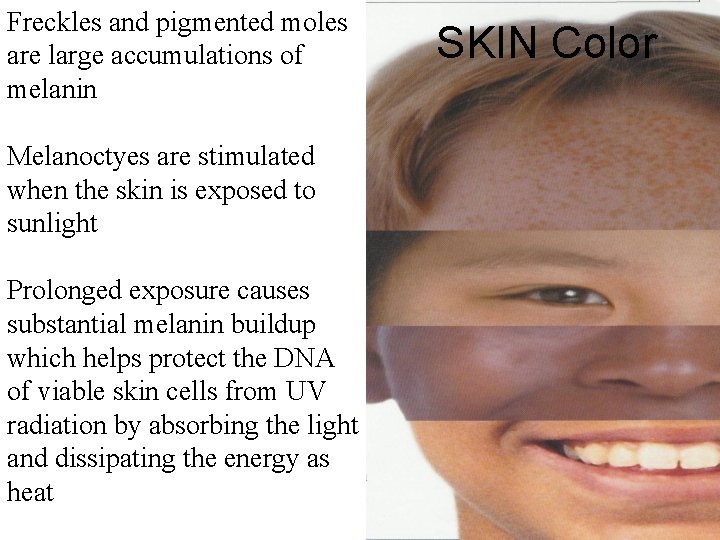 Freckles and pigmented moles are large accumulations of melanin Melanoctyes are stimulated when the