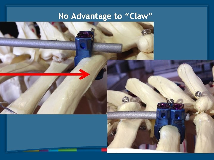 No Advantage to “Claw” 